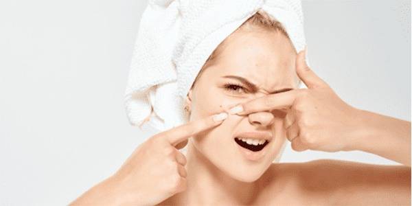 Boutons sur le visage : comment limiter leur apparition ?