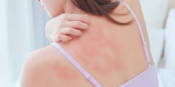 Peau sensible et exigeante, quelle routine adopter ?