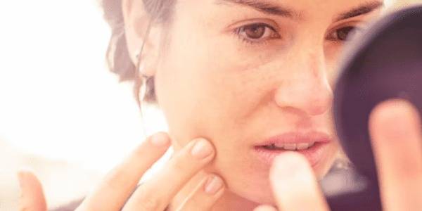 Masque de grossesse visage : causes et prévention