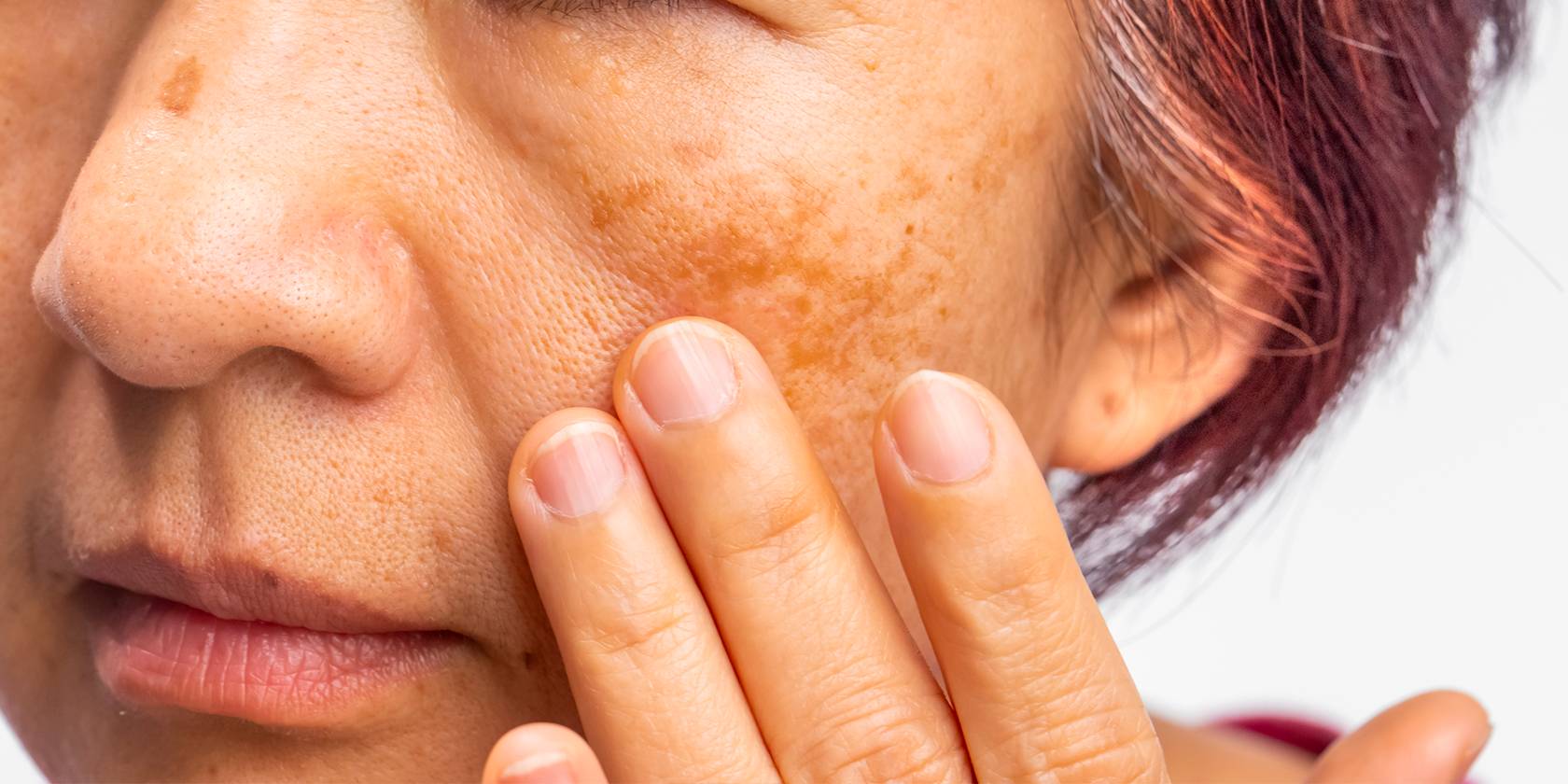 Stress oxydatif : le comprendre et le combattre